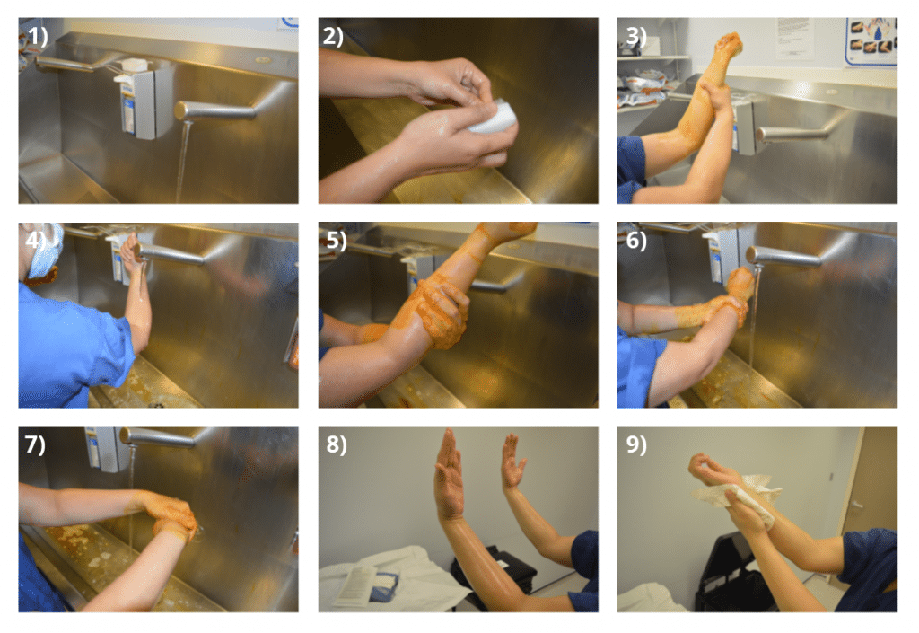 Fig 2 - Scrubbing In. The aim is to decotaminate the hands and forearms.