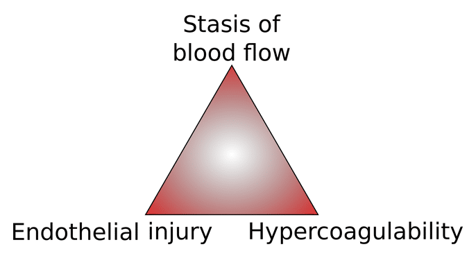 Fig 1 - Virchow's triad; factors that can predispose an individual to thrombosis.